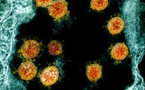 Descubren en Brasil una nueva cepa "super mutante" de coronavirus