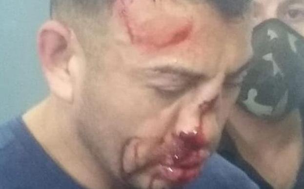 Crimen de Los Toldos: tras el ataque de presos refuerzan la seguridad del acusado