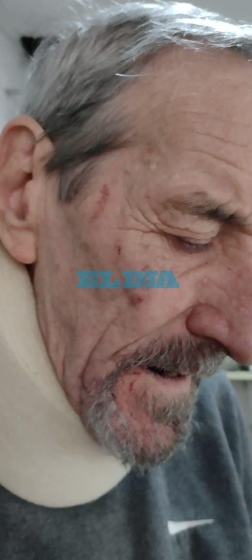 Robo y salvaje ataque al sereno de una fundación en B. Norte: amenazan con matarlo y le arrancan dientes