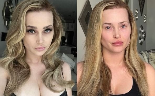 Una influencer "arrepentida de las cirugías" y con duro mensaje: "Las redes no son la vida real"