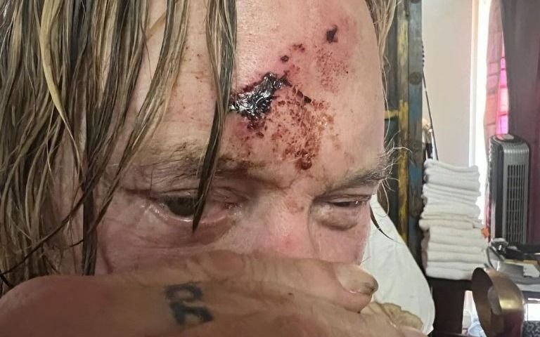 Los motivos de la impactante imagen de Mickey Rourke con su rostro y manos ensangrentadas  