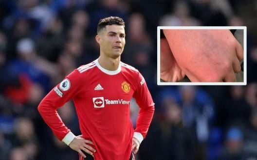 Cristiano Ronaldo agredió a un fanático con autismo y le rompió el celular tras perder frente a Everton