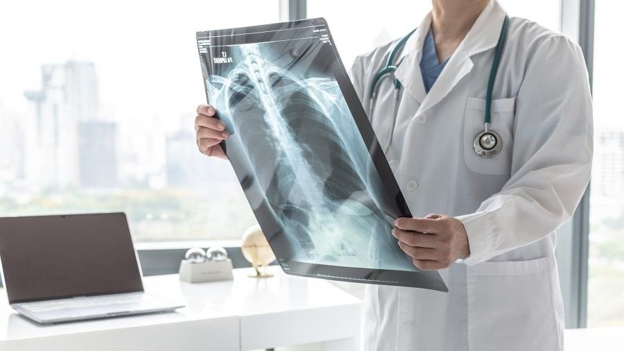 Cáncer de pulmón: llega una nueva droga