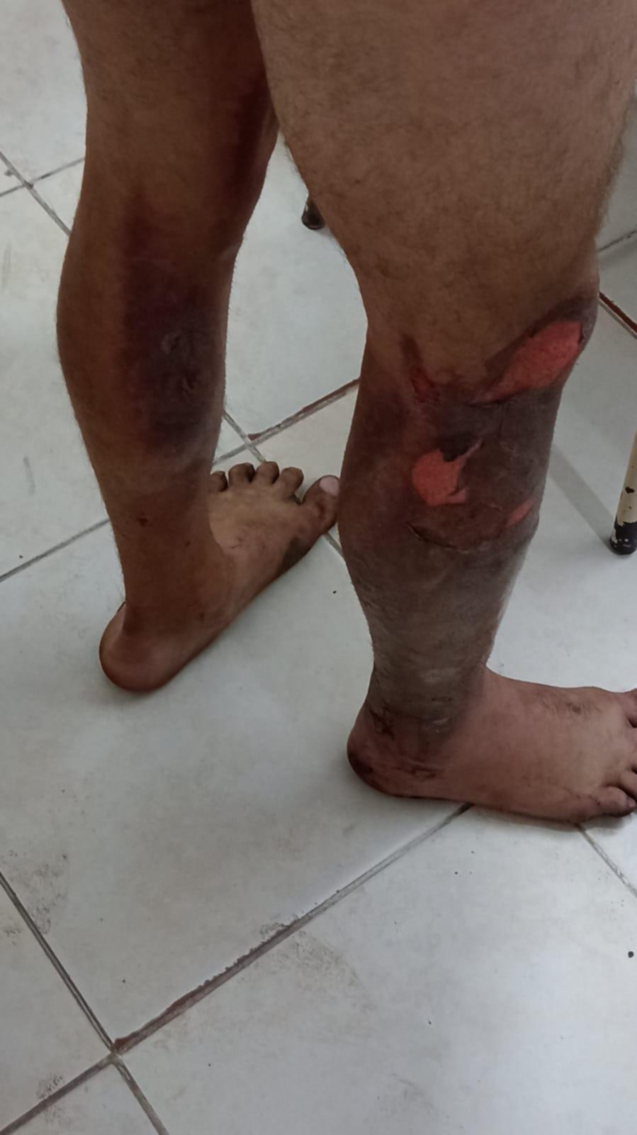 Un detenido en Chascomús por un crimen oculto detrás de un incendio