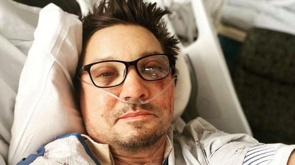 Renner pidió que no lo dejen “conectado a una máquina”