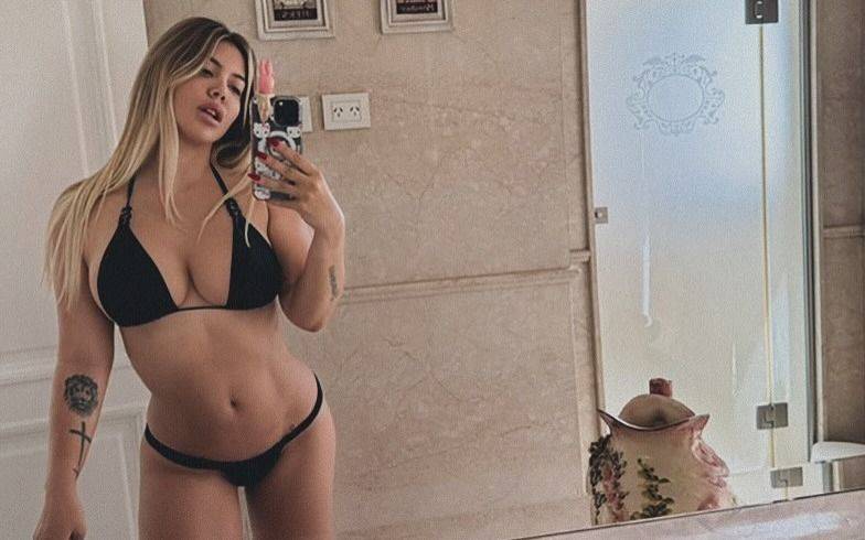 Wanda Nara mostró los resultados de su cirugía estética