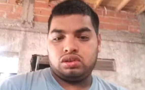 Desesperación en La Plata por un joven con retraso madurativo que lleva 48 horas desaparecido