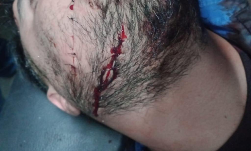 Podrían extender el paro por un colectivero herido