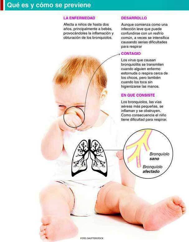 Bronquiolitis:  advierten que fumar en la casa sextuplica el riesgo para los bebés