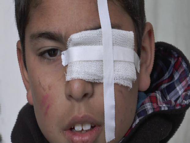 San Carlos: un nene de 8 años atacó a otro de 11 con una piedra