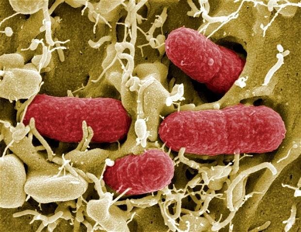 Detectan bacteria resistente a todo y temen el fin de los antibióticos