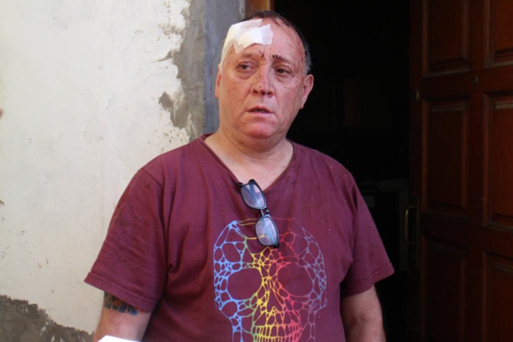 Dos hermanos frustraron una entradera a los golpes y terminaron en un hospital