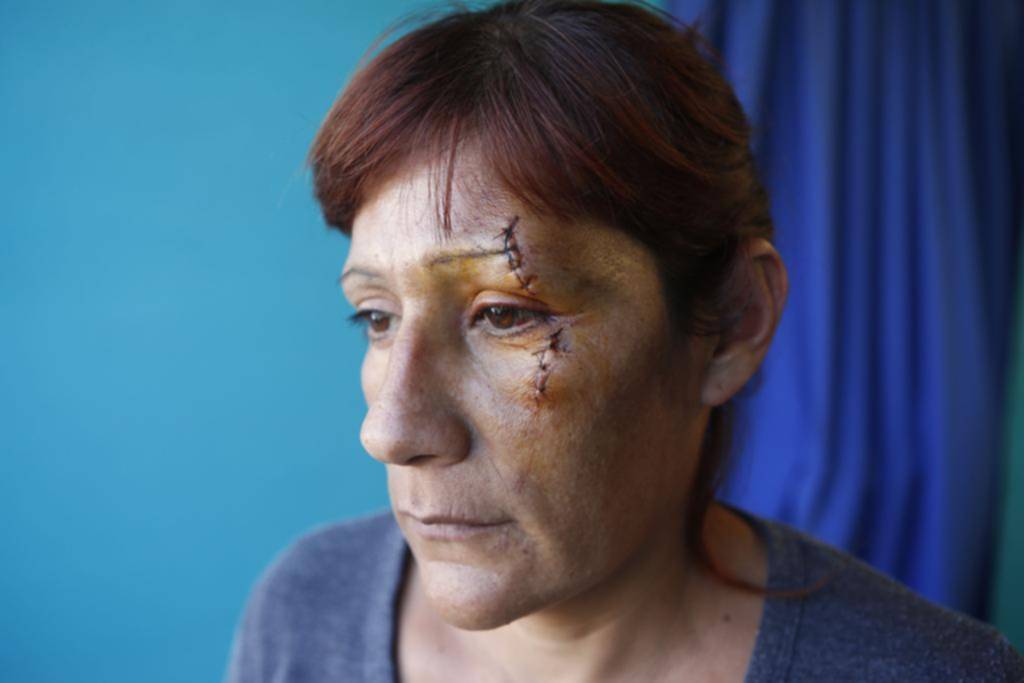 Una familia terminó herida por el ataque de otra en Tolosa