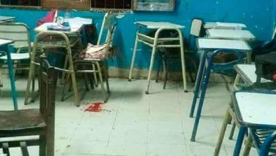 Un chico de 16 años baleó en la cara a una compañera de 14 en plena clase