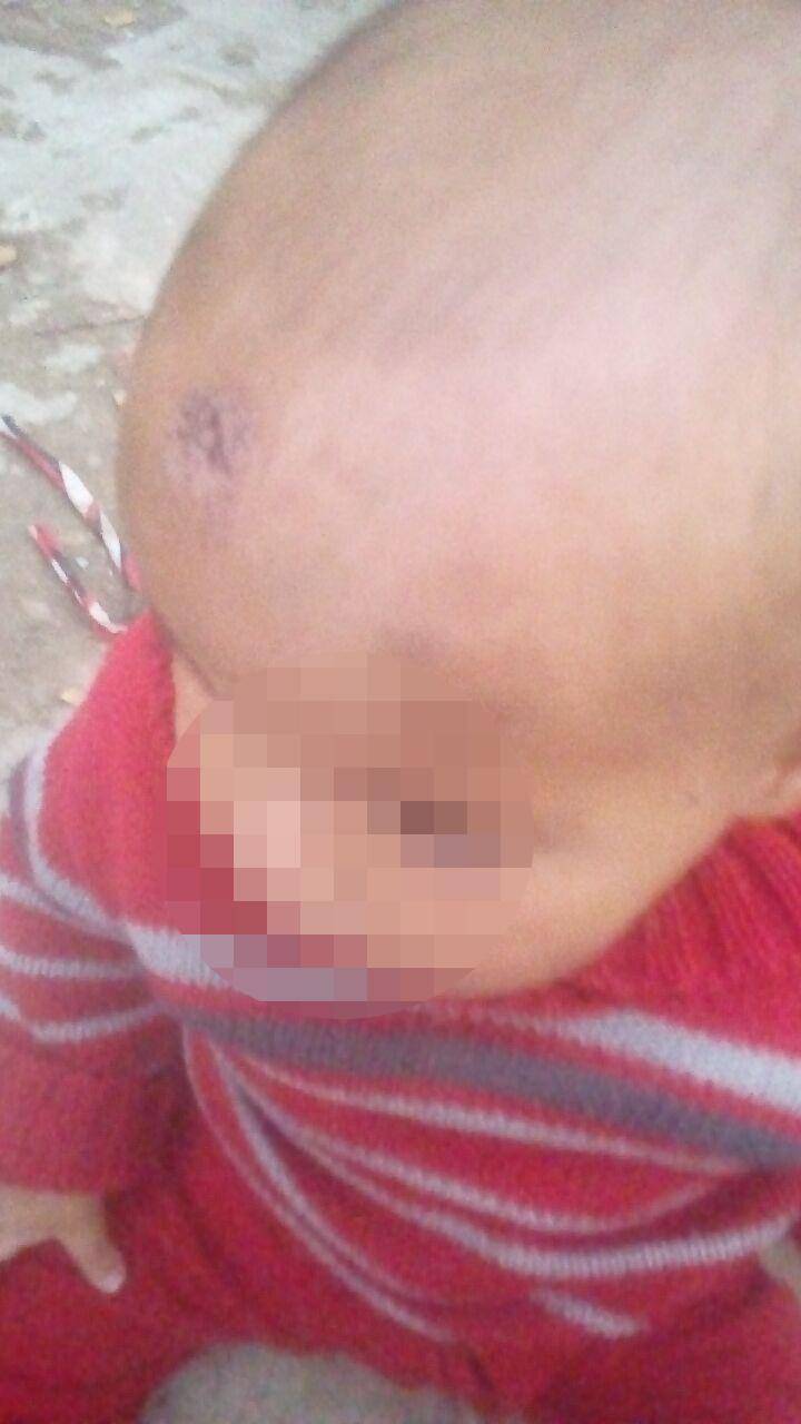 Son graves las lesiones de la beba rescatada por la denuncia de la niñera