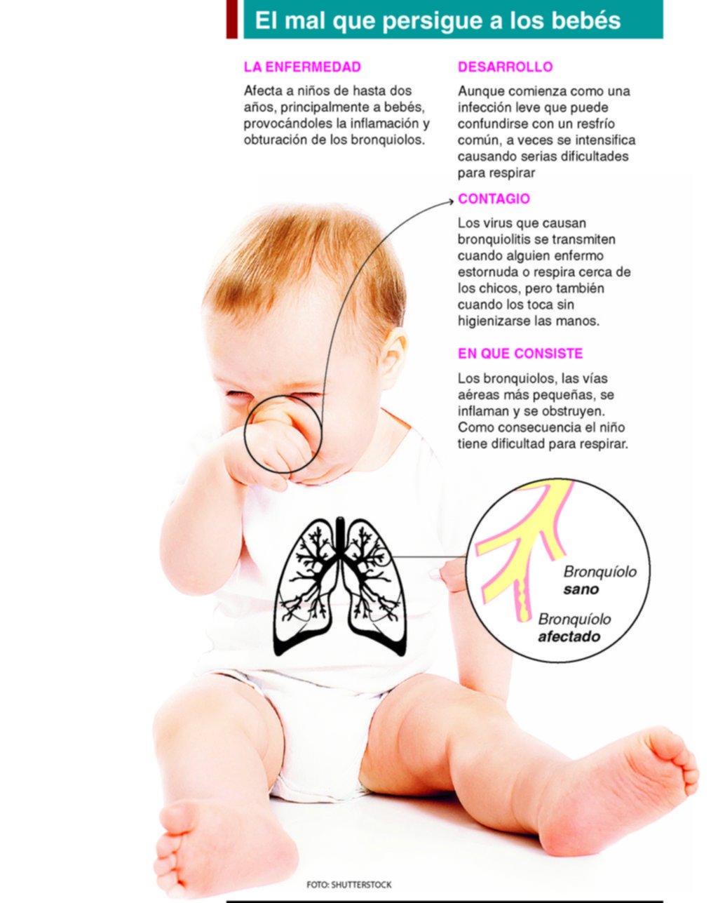 Alertan que el 70% de los menores de 2 años puede tener bronquiolitis