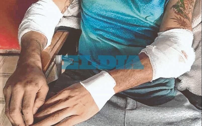 Villa Ponzati: terminó herido tras detener a un delincuente que quiso robar en su almacén