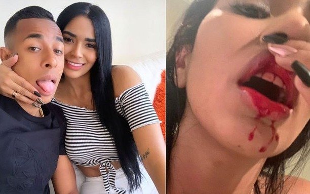 "Las fotos son una recopilación de varias heridas que me causó", dijo la ex pareja de Villa