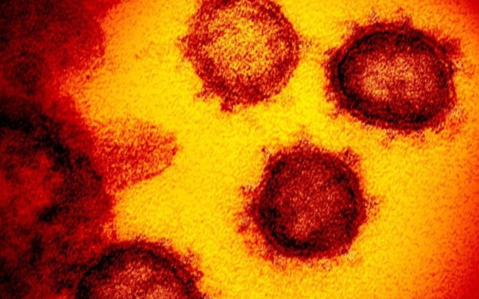 Anuncian que se completó el desarrollo de un anticuerpo que neutraliza al virus SARS-COV-2