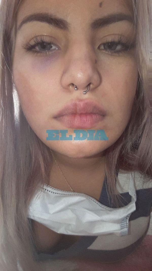 Delincuentes intentaron estrangular a una repartidora