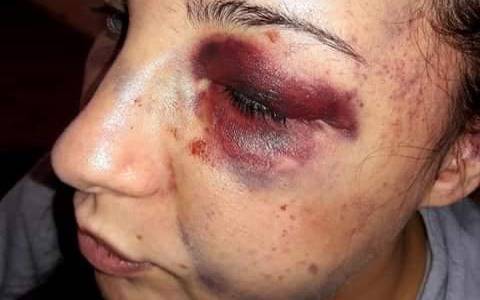 La policía llegó justo cuando su ex pareja la estaba golpeando