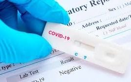 COVID-19: ¿A más testeos más cantidad de casos positivos? La palabra de los expertos