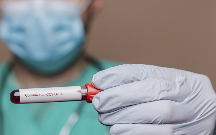 La vitamina D y su importancia para combatir al coronavirus: ¿cómo se adquiere y qué efectos produce?