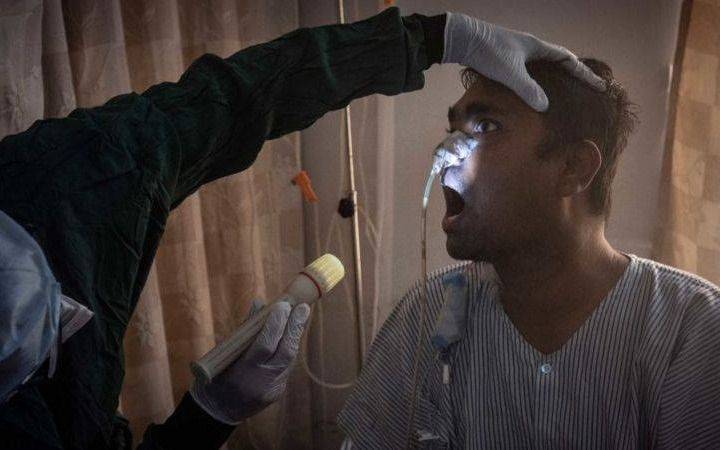Preocupa en Uruguay un caso de hongo negro: qué es y su vínculo con pacientes COVID-19