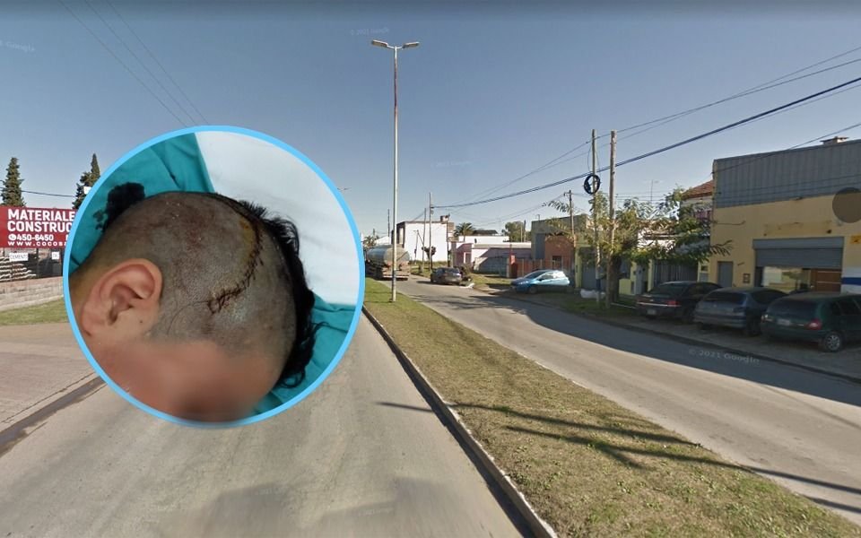 Alumno del Normal 3 fue atropellado y sufrió fractura de cráneo: buscan testigos