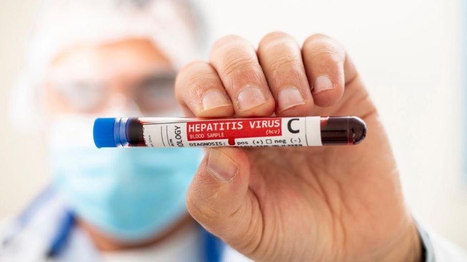 Hepatitis aguda en chicos: cuáles son los signos de alarma