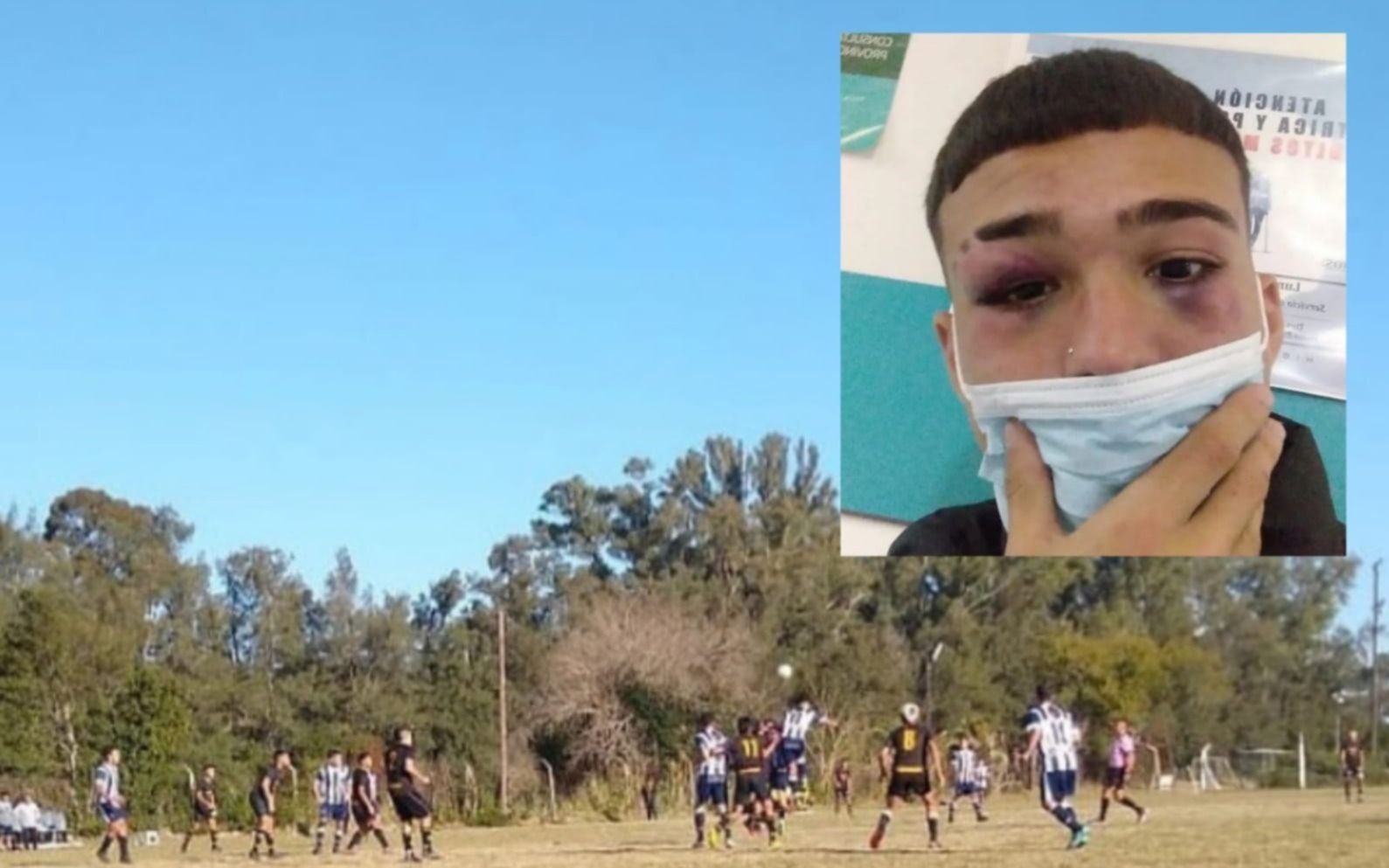 Otra vez la violencia: brutal ataque a un juvenil de Peñarol en un partido de la Liga Amateur Platense