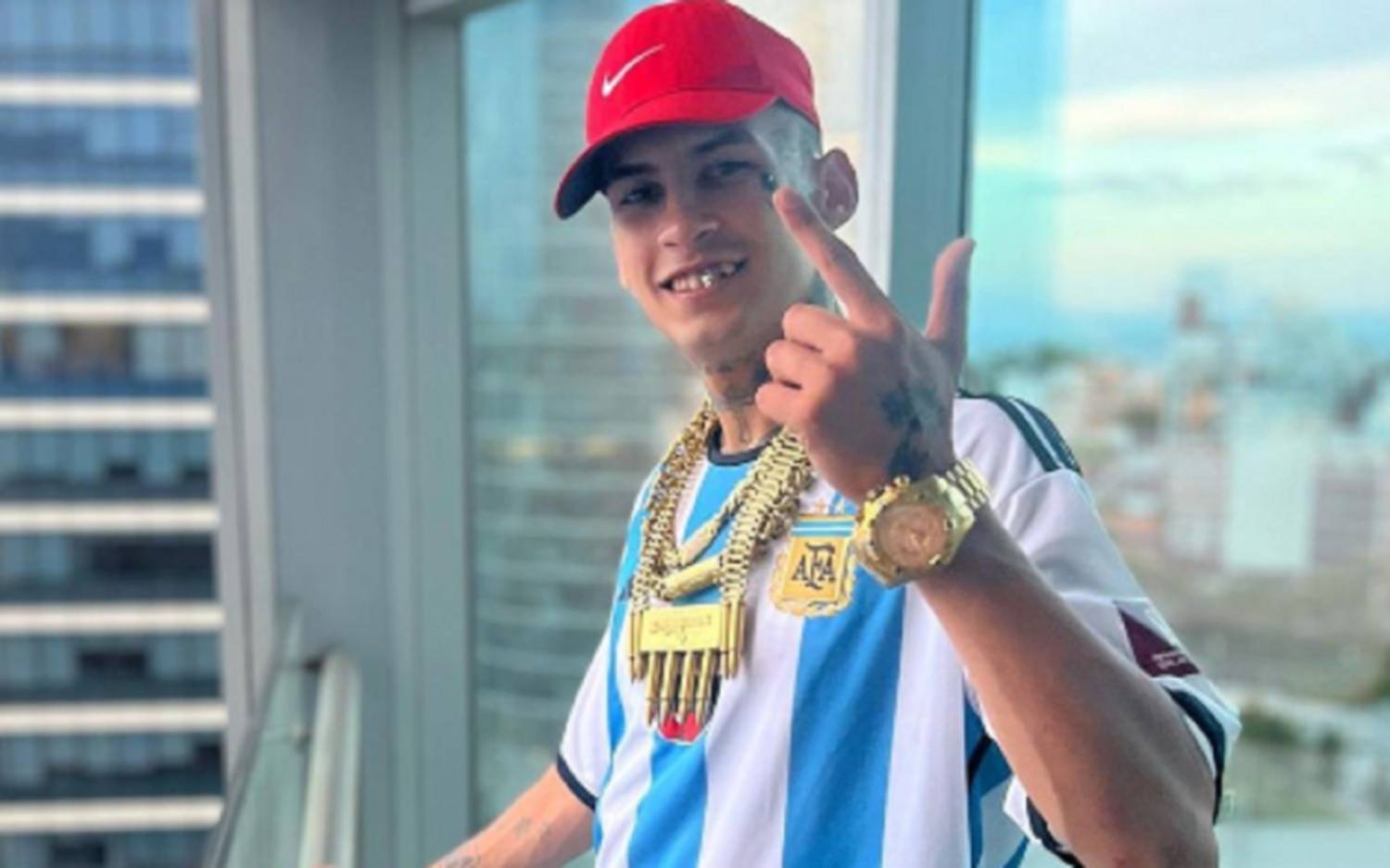 Quiere lucir "L-Gante": la costosa dentadura que se hizo el artista con oro 18 kilates y diamantes