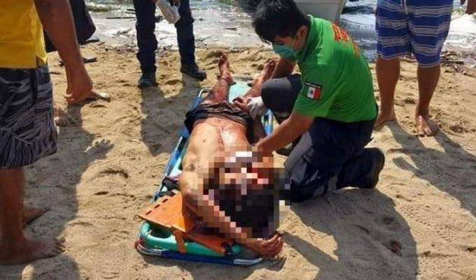 Tres argentinos fueron brutalmente atacados a machetazos en México