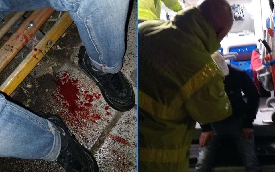 Salvaje robo en La Plata: delincuentes le dieron una paliza a un joven y huyeron con una moto