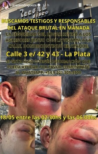 Famosa influencer denunció una feroz golpiza a su novio en un boliche de La Plata: "En manada"