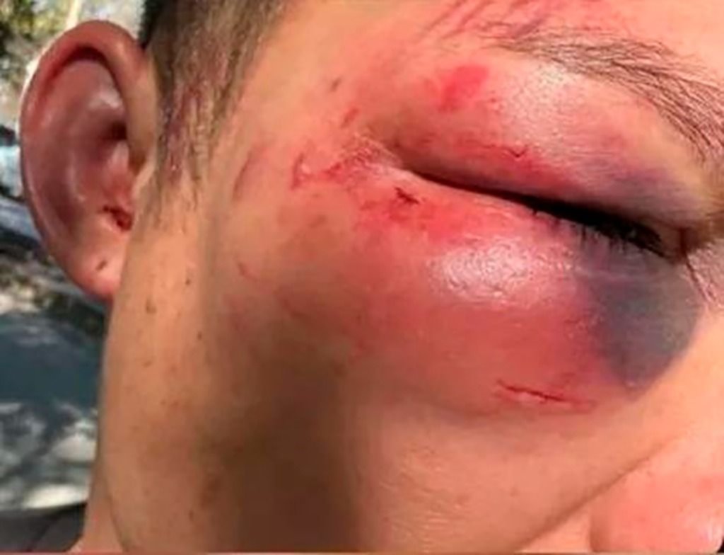Violencia sin control: brutal ataque a un joven a la salida de un boliche