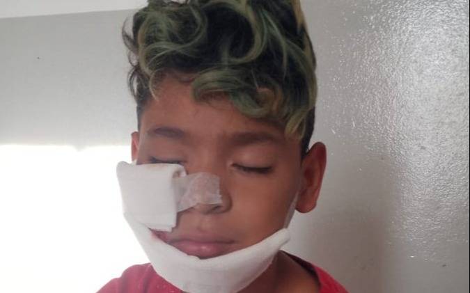 Bernal Oeste: Policía bonaerense disparó balas de goma a cara de niño de 9 años