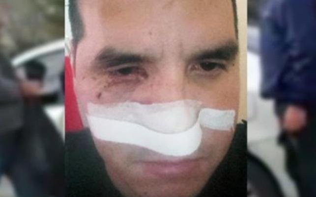 “No lo maté porque se cubrió con la mujer y los hijos, si no lo pongo como una media”