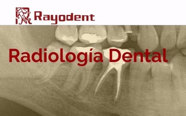 Rayodent te ofrece los más avanzados estudios y análisis dentales