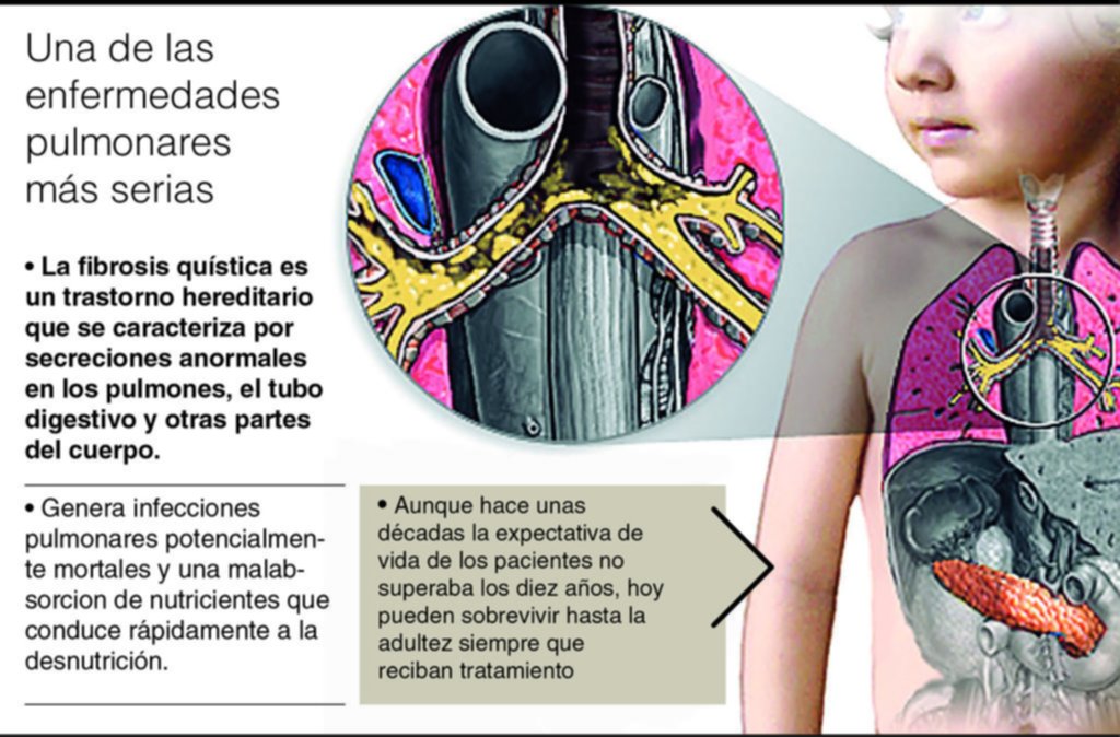 Denuncian falta de medicación para chicos con fibrosis quística