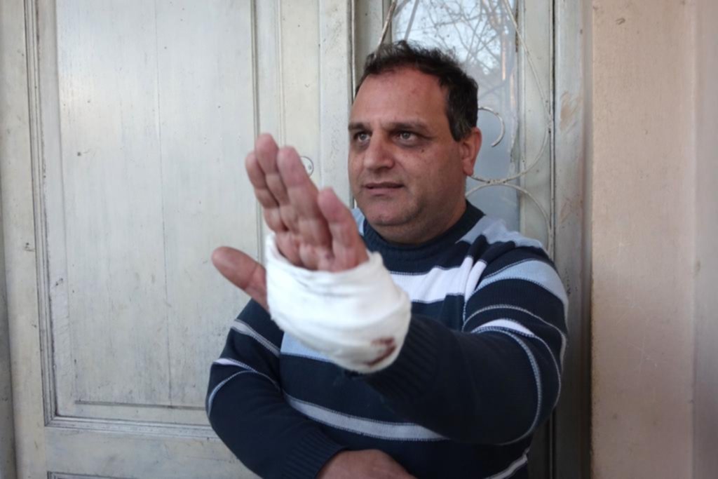 La ola de robos violentos en La Plata mete miedo: tres personas baleadas en tres días