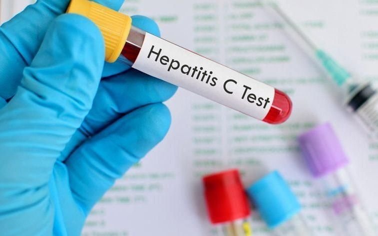 Buscan dar con personas que no saben que sufren Hepatitis C