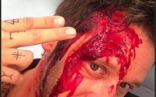 La foto de Benjamín Vicuña que asustó a sus fans