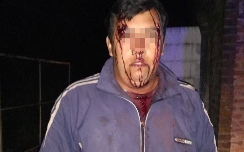 No le pagaban y cuando se negó a terminar la obra lo secuestraron y golpearon