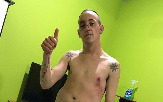 Denunció que cuatro patovicas lo golpearon en un bar del Centro