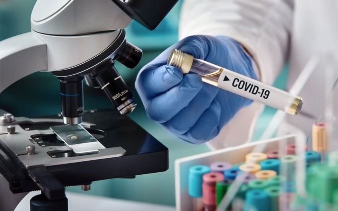 Por el coronavirus, pronostican una caída del 7,3% de la economía argentina