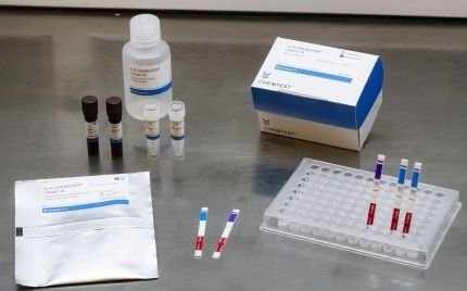 La UNQ y la UNSAM crearon test rápido para Covid-19