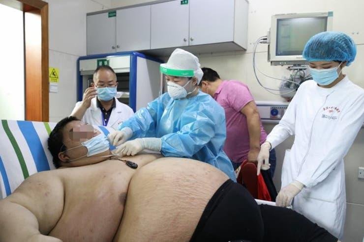 Un joven chino engordó más de cien kilos durante el aislamiento