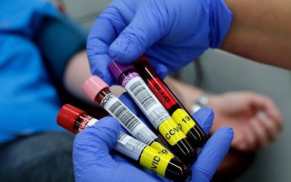 Cerca de 150 pacientes mejoraron con aplicación de plasma de recuperados de coronavirus