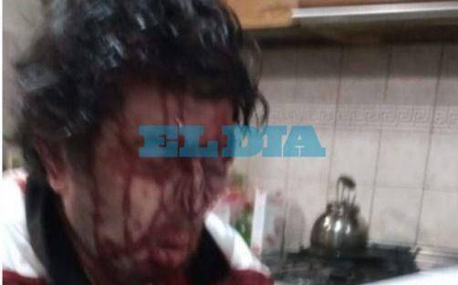 Ex juez sufrió una salvaje entradera en su casa de La Plata
